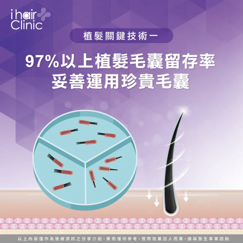 97%以上毛囊留存率-植髮技術有哪些