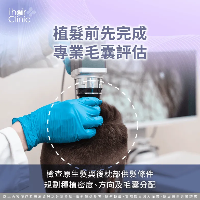 頭頂加密植髮前評估毛囊條件與種植密度規劃 植髮評估-頭頂加密植髮 效果