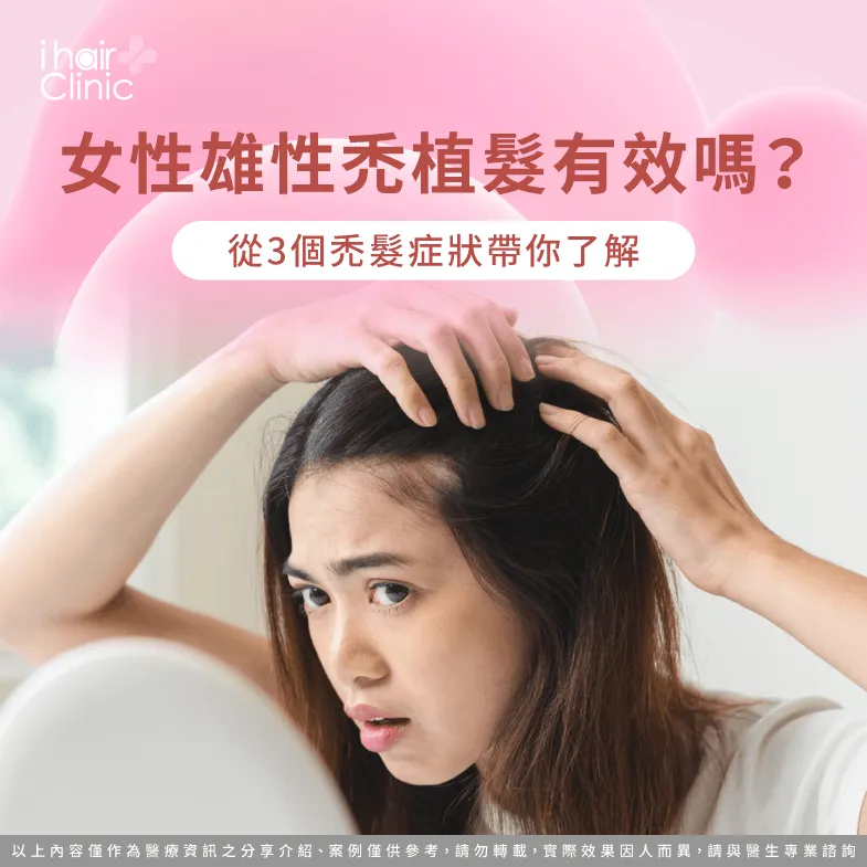 3個雄性禿症狀分析植髮優勢-女性雄性禿 植髮