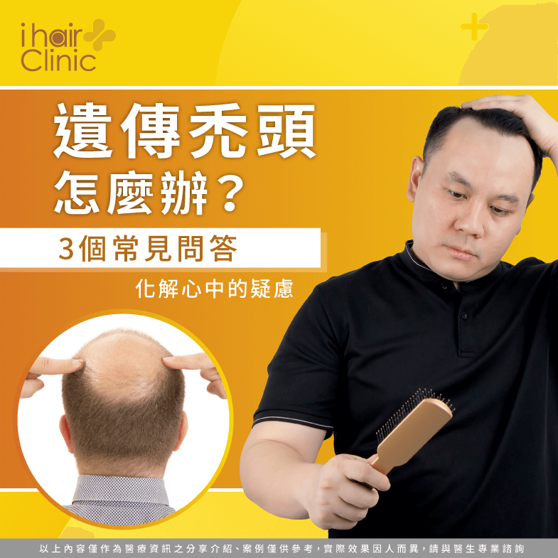 遺傳禿頭怎麼辦 3個問答為你詳細解答 Ihair風華御髮 遺傳禿頭怎麼辦 3個問答為你詳細解答 Ihair風華御髮