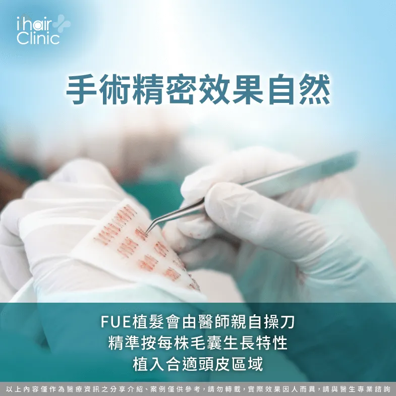 FUE植髮更加精密且效果更自然-fue 植髮 疤痕