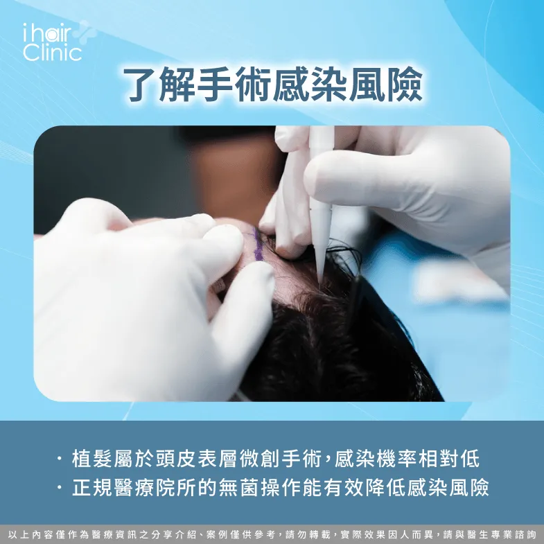 植髮手術感染風險-植髮會感染嗎