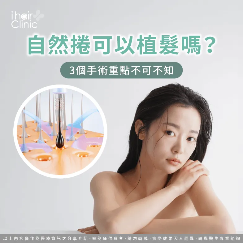 自然捲植髮3大手術重點一次了解-自然捲 植髮