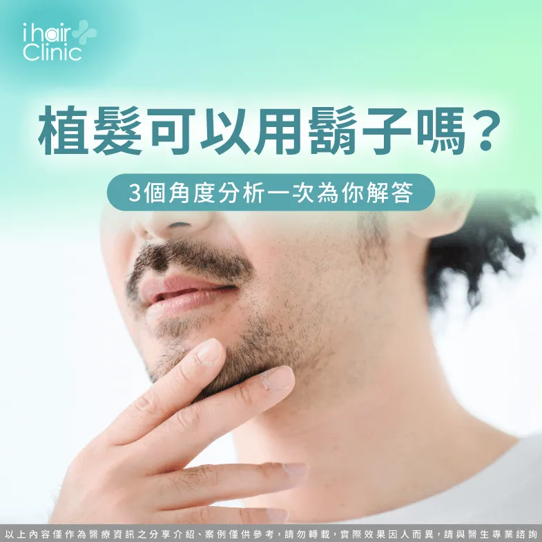 用鬍子植髮的3點建議帶你看-植髮可以用鬍子嗎