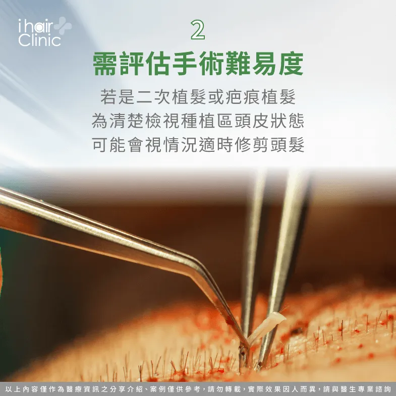 若有二次植髮與疤痕植髮等情況也可能需剃髮-頭髮 種植