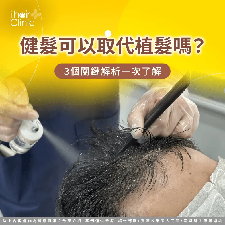 健髮 可以取代植髮嗎-健髮 植髮 差別