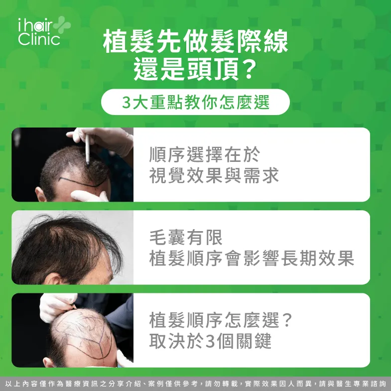 植髮先做髮際線還是頭頂?最佳順序與規劃解析 植髮 髮際線 頭頂-植髮規劃先做髮際線還是頭頂