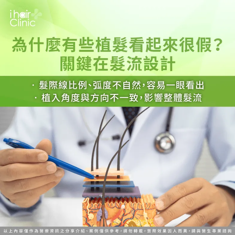 髮流設計-植髮效果為什麼差很多