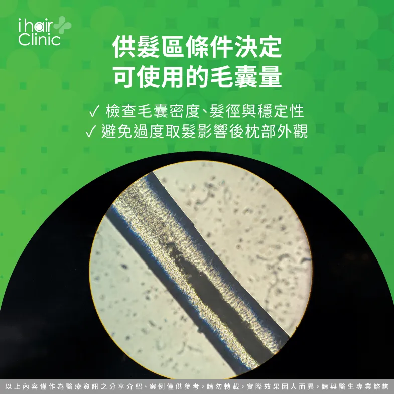 植髮供髮區怎麼評估?毛囊密度、髮徑與穩定性是關鍵 供髮區條件-大面積禿頭可以植髮嗎