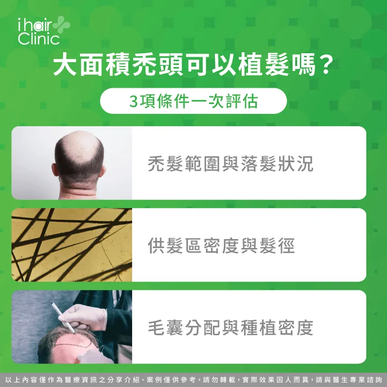 大面積禿頭可以植髮嗎?禿髮範圍、供髮區與毛囊配置3項評估 大面積禿頭植髮 效果-大面積禿頭可以植髮嗎