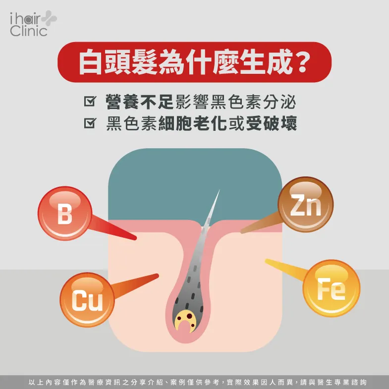 白髮生成原因-白髮能植髮嗎