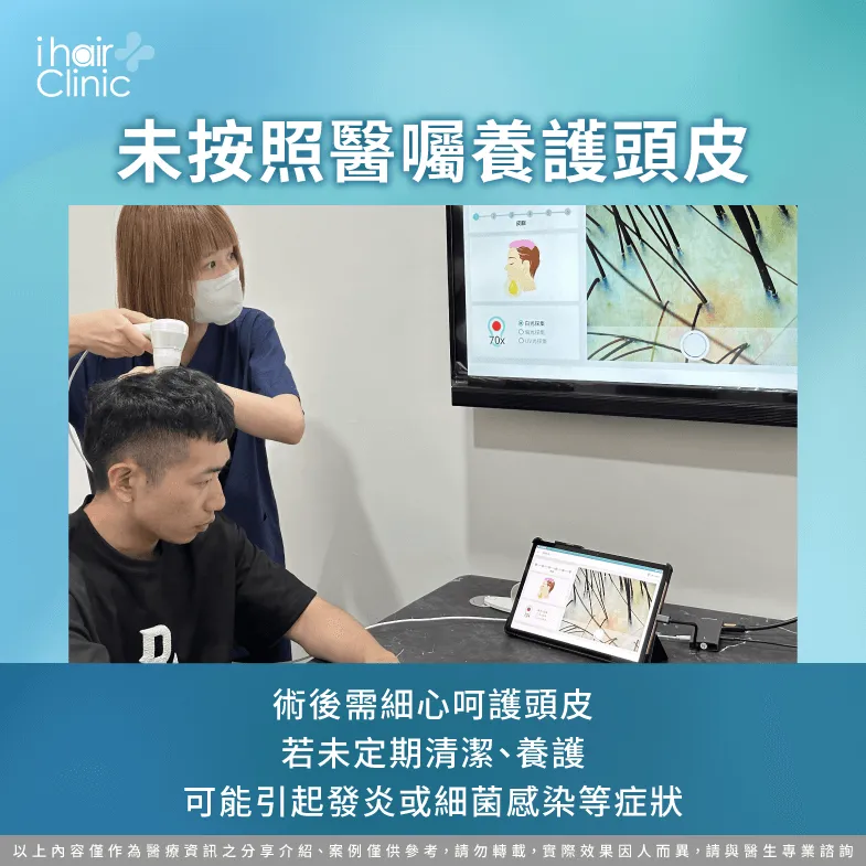 未按醫囑養護頭皮可能影響毛囊健康-植髮區 掉髮