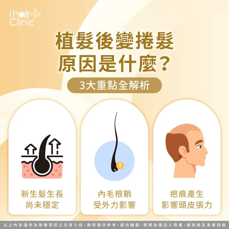 植髮後變捲髮的3點可能原因帶你看-植髮 後 捲髮