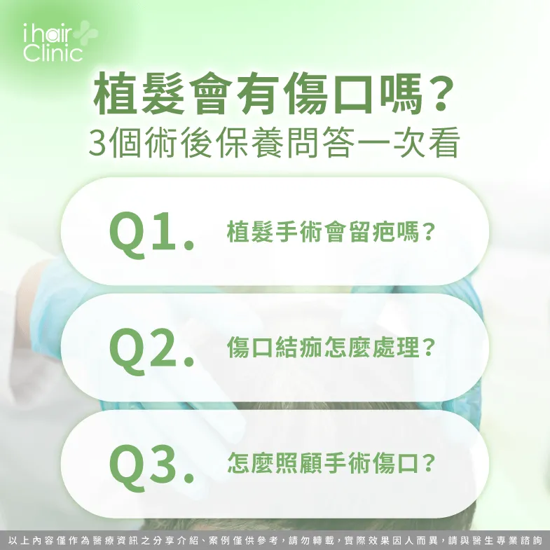 植髮後會有傷口嗎?3大術後保養重點一次帶你看了解 植髮後照顧傷口的3大Q&A一次看-植髮 後 傷口
