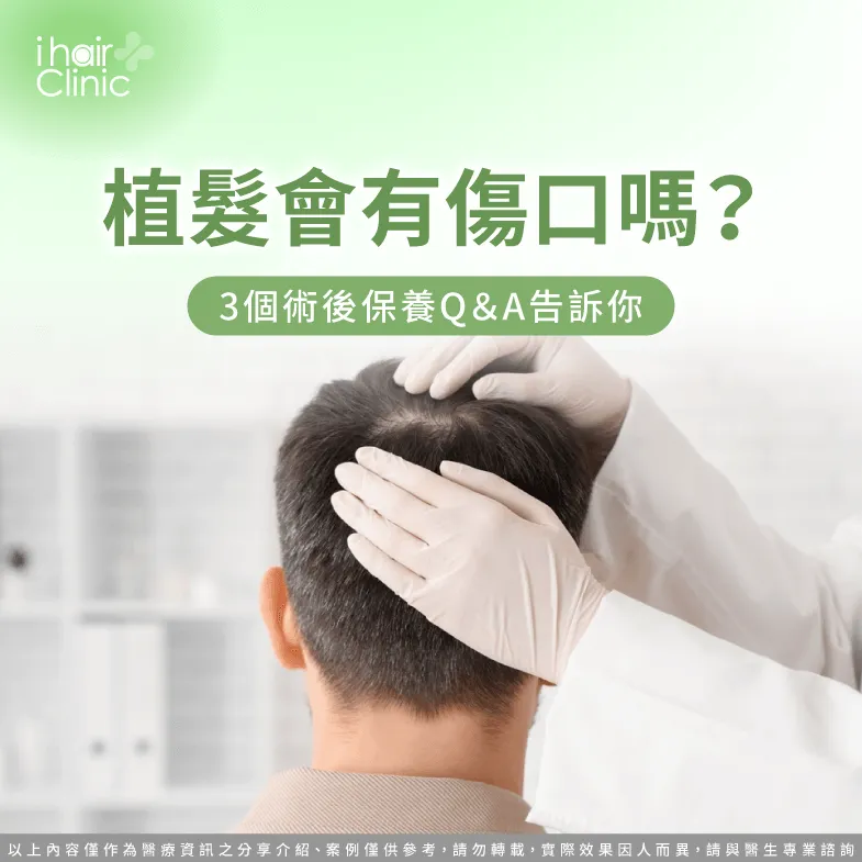 植髮後會有傷口嗎?3大Q&A解析告訴你術後的傷口養護重點有哪些 植髮後照顧傷口的3大重點一次分享-植髮 會 有 傷口 嗎