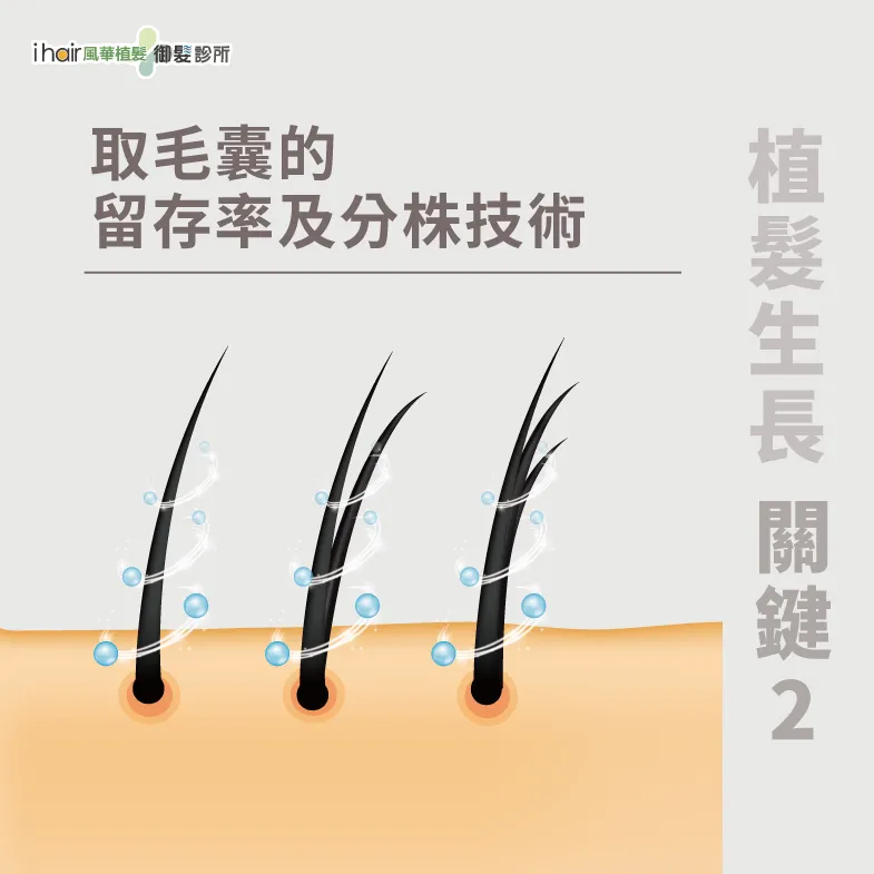 取毛囊的技術及留存率-植髮會長長嗎