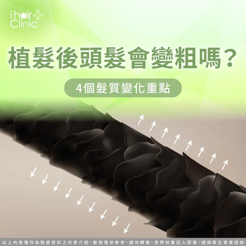 植髮後髮質會改變嗎?解析髮絲粗細與成熟過程 植髮後會和原本頭髮一樣粗嗎-植髮 頭髮 粗細