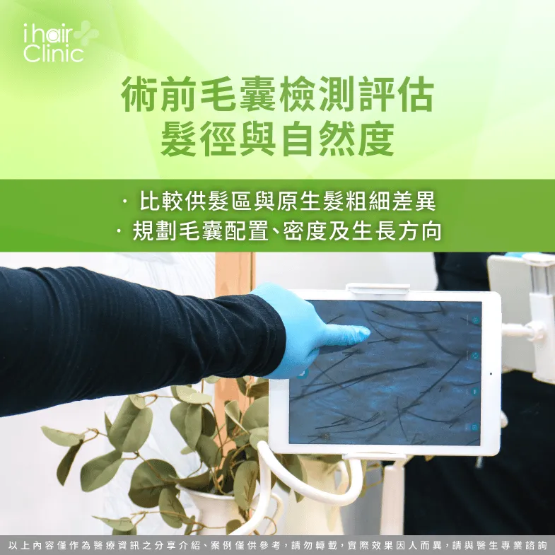 術前毛囊檢測:評估髮徑、毛囊配置與植髮自然度 術前毛囊檢測-植髮 頭髮 粗細