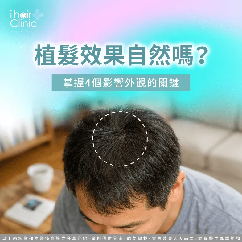 植髮效果自然不自然?解析髮線、密度與毛流設計 植髮效果自然嗎-植髮 自然