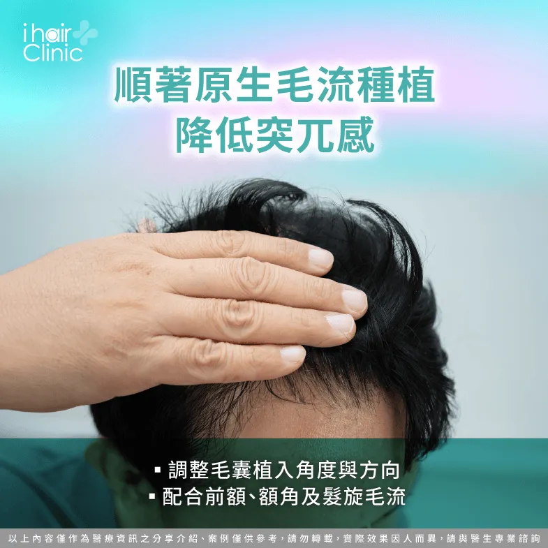 順著原生毛流種植:調整毛囊植入角度與方向 毛流方向-植髮效果自然嗎