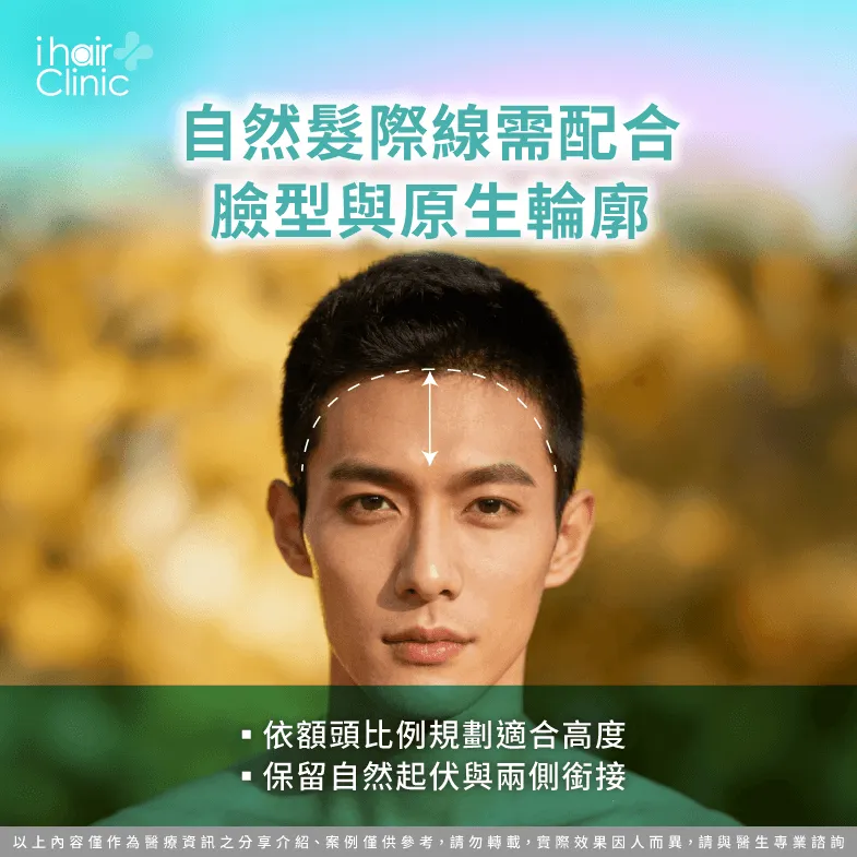 自然髮際線設計:配合臉型、額頭比例與原生輪廓 髮際線設計-植髮效果自然嗎