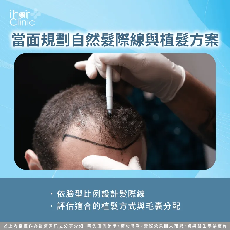 結合臉型、毛流與毛囊分配設計自然髮際線 實際規劃植髮方案-植髮可以只做線上諮詢嗎