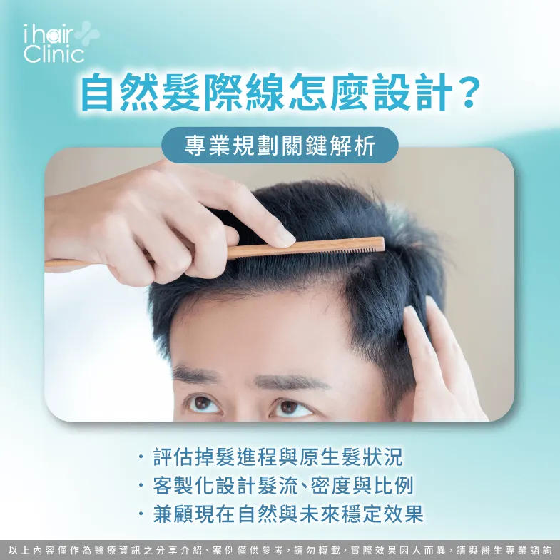 自然髮際線怎麼規劃?專業植髮設計解析 自然髮際線設計-M型禿植髮髮際線要多低
