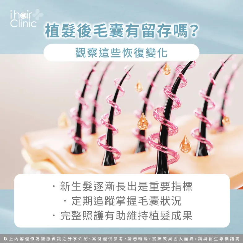 植髮後毛囊有成功存活嗎?恢復期觀察重點 觀察變化-植髮醫師如何判斷毛囊留存率