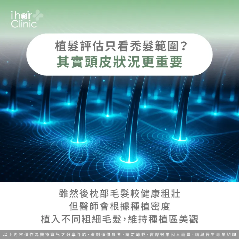 頭皮健康有多重要?植髮評估重點一次了解 頭皮健康-植髮評估時為什麼要看頭皮狀況