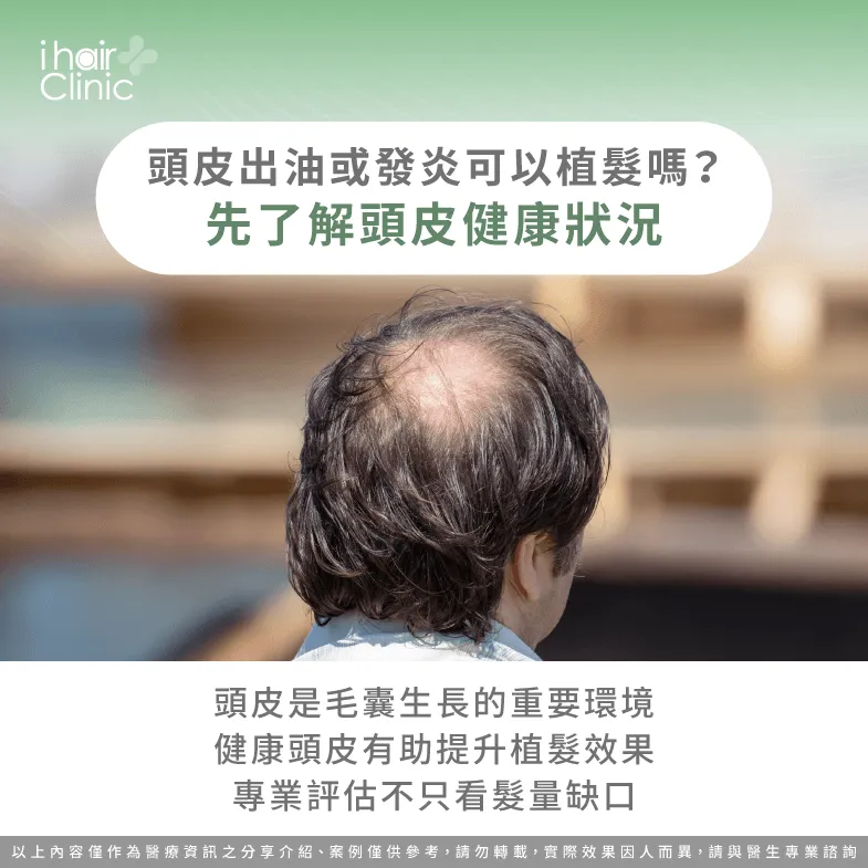 頭皮出油、發炎會影響植髮嗎?醫師解析重點 頭皮發炎-植髮評估時為什麼要看頭皮狀況