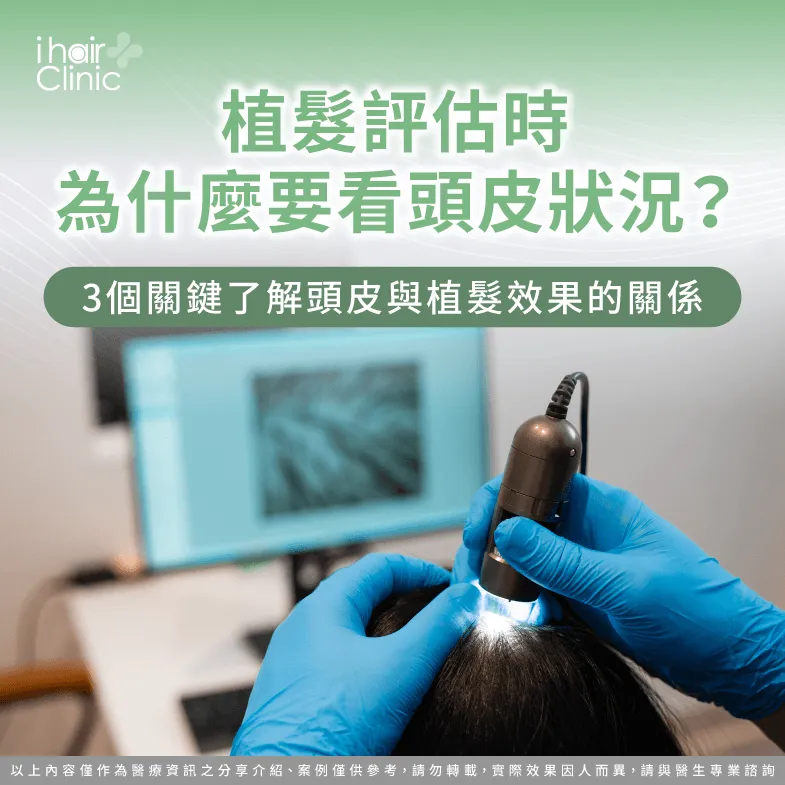 植髮評估時為什麼要看頭皮狀況?3個重點解析 植髮評估時為什麼要看頭皮狀況-植髮頭皮 狀況