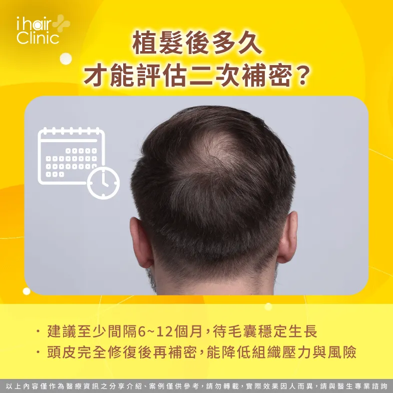 植髮後恢復期-植髮補密需要間隔多久