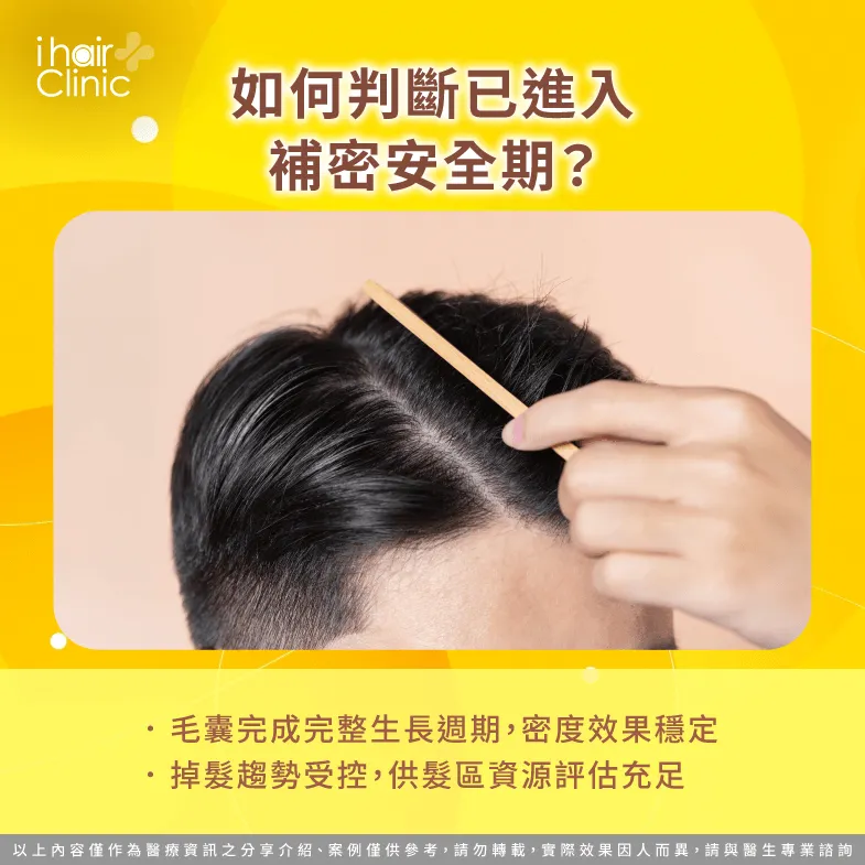 判斷安全期-植髮補密需要間隔多久