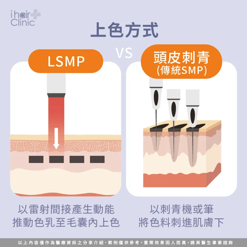 上色方式不同-LSMP是刺青嗎