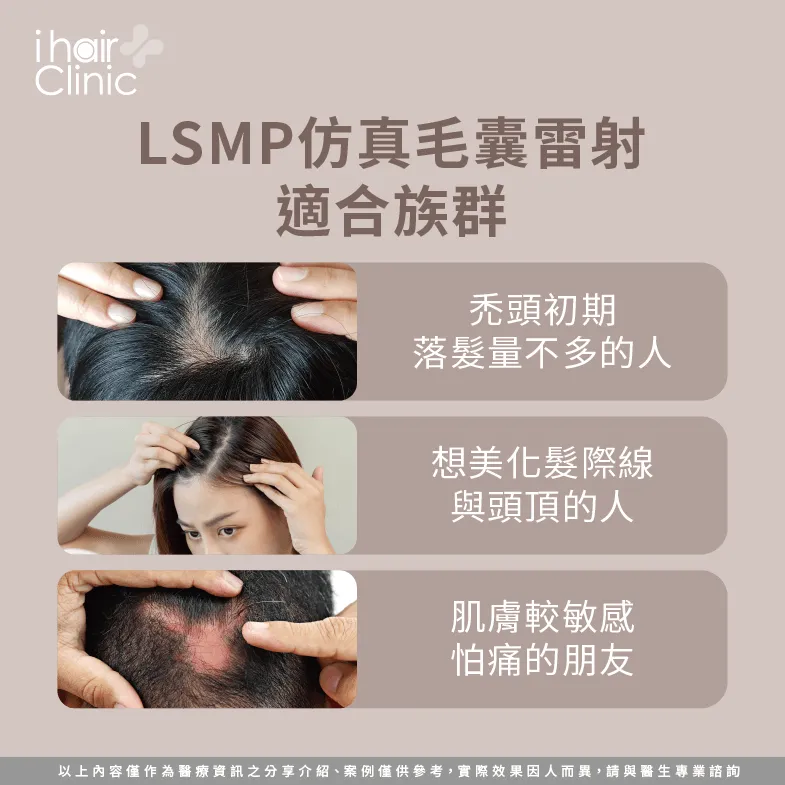 適合LSMP的族群-SMP仿真毛囊是什麼