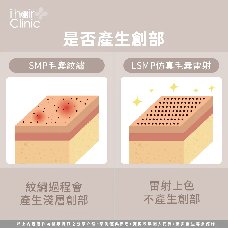 創部比較-SMP仿真毛囊是什麼