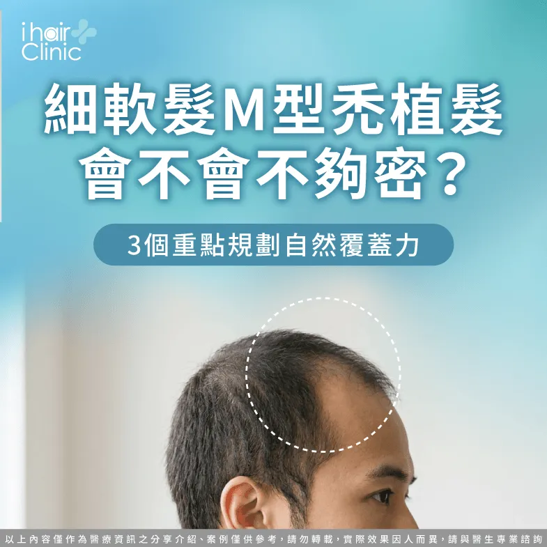 細軟髮M型禿植髮怎麼規劃?3個重點提升自然覆蓋力 細軟髮M型禿植髮-頭髮細 M型禿植髮