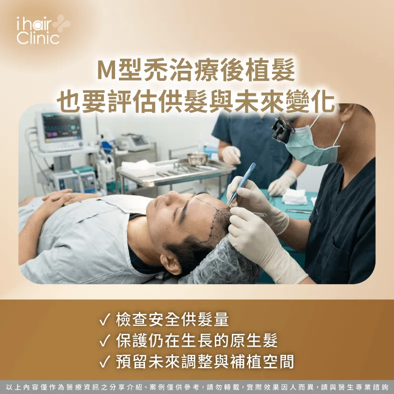 M型禿治療後植髮怎麼規劃?評估供髮量、原生髮與未來變化 長期植髮規劃-M型禿用藥後要植髮嗎
