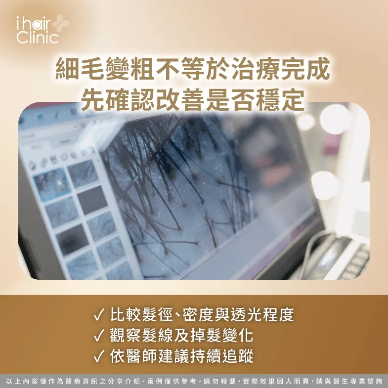 細毛變粗就代表治療穩定嗎?從髮徑、密度與落髮變化評估 治療反應評估-M型禿用藥後要植髮嗎