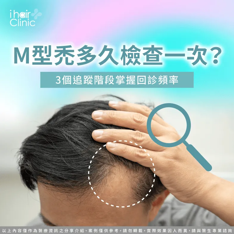 M型禿多久檢查一次-M型禿回診頻率