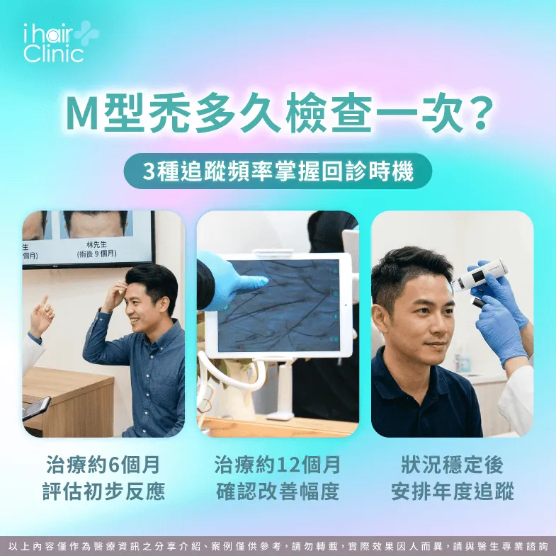 M型禿回診頻率-M型禿多久檢查一次