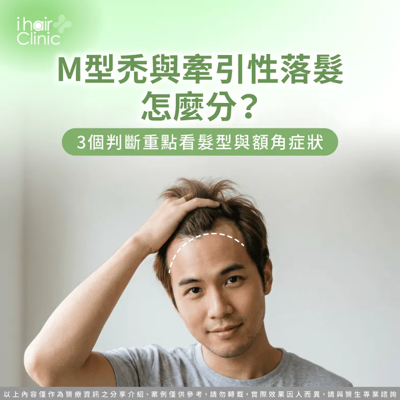 M型禿 牽引性落髮差別-M型禿 牽引性落髮