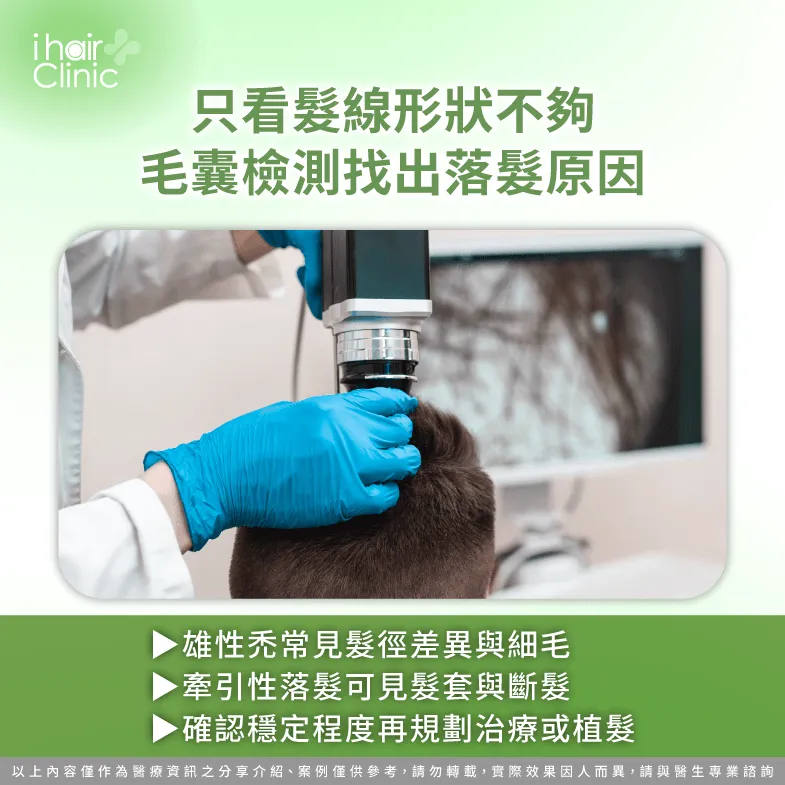 毛囊檢測判斷-M型禿 牽引性落髮差別