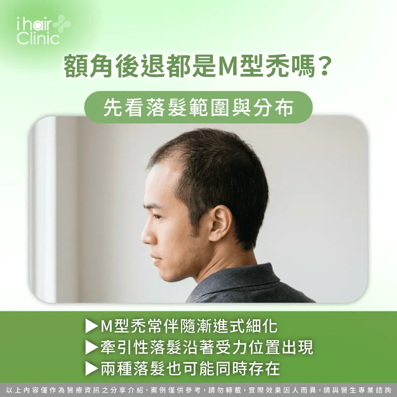 落髮範圍與分布-M型禿 牽引性落髮