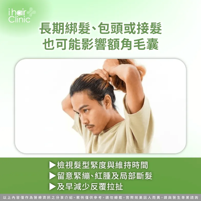 髮型拉扯習慣-M型禿 牽引性落髮差別