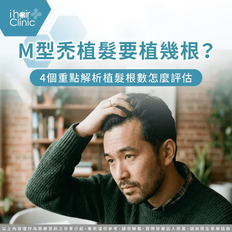 M型禿植髮要植幾根?4個重點解析植髮根數怎麼評估 M型禿植髮幾根-M型禿植髮 根數