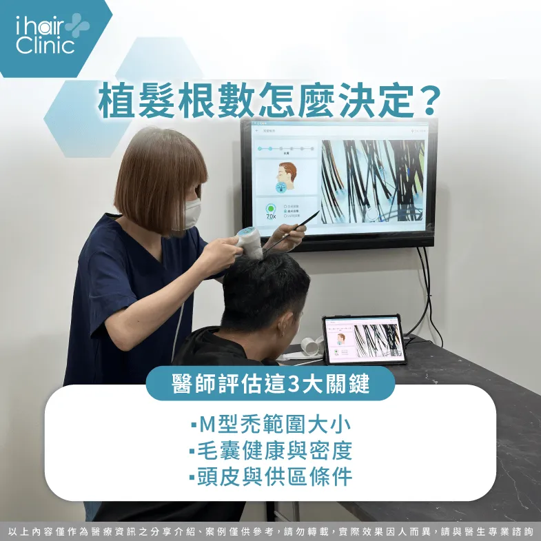 植髮根數怎麼評估?醫師解析3大關鍵因素 M型禿植髮根數-植髮根數