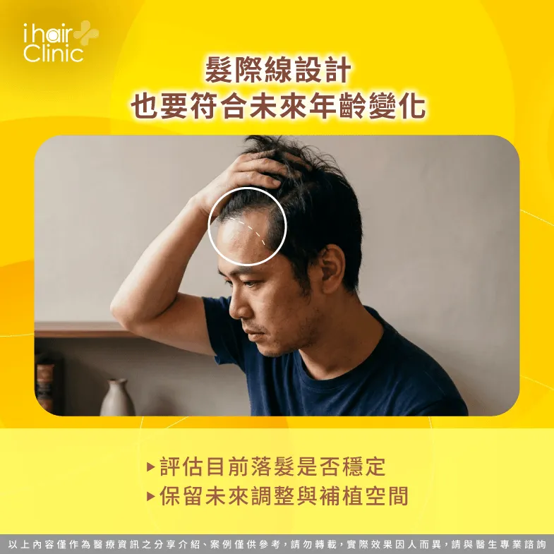 年齡與落髮趨勢-M型禿植髮額角要補多深