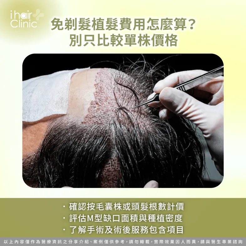植髮費用計算-免剃髮M型禿植髮比較貴嗎