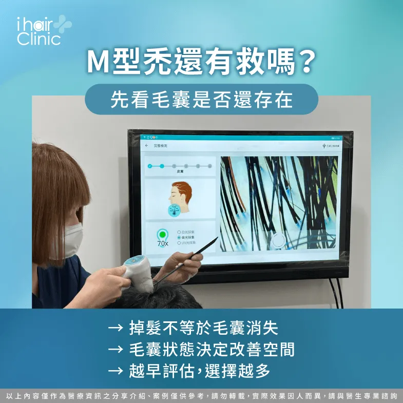 M型禿還有機會恢復嗎?毛囊狀態是關鍵 M型禿還有救嗎-M型禿可以恢復嗎